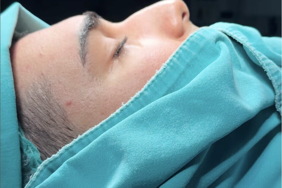 How much is a nose job in Turkey CAD? How much is a nose job in Turkey CAD?