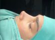Which country has the best nose job surgeons?