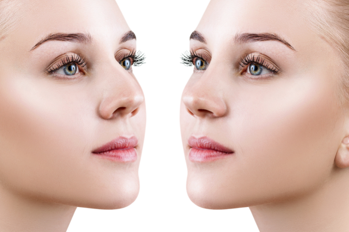 How much to save for a nose job in Turkey? How much to save for a nose job in Turkey?