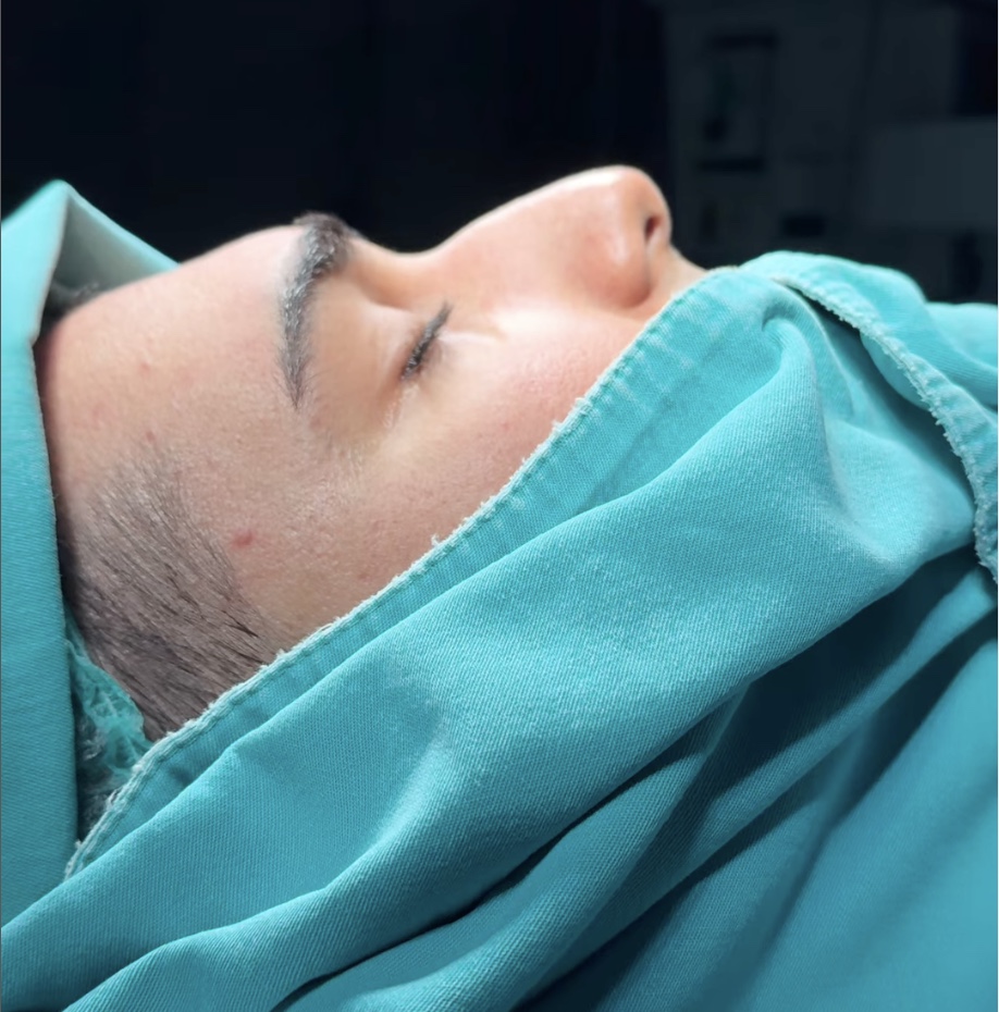 How much is a nose job in Turkey CAD? How much is a nose job in Turkey CAD?