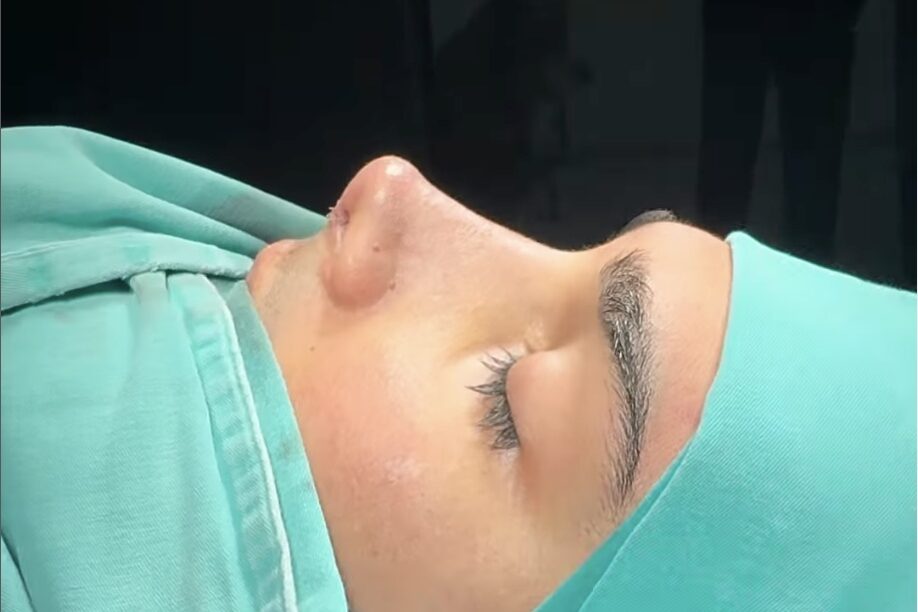 Which country has the best nose job surgeons? Which country has the best nose job surgeons?