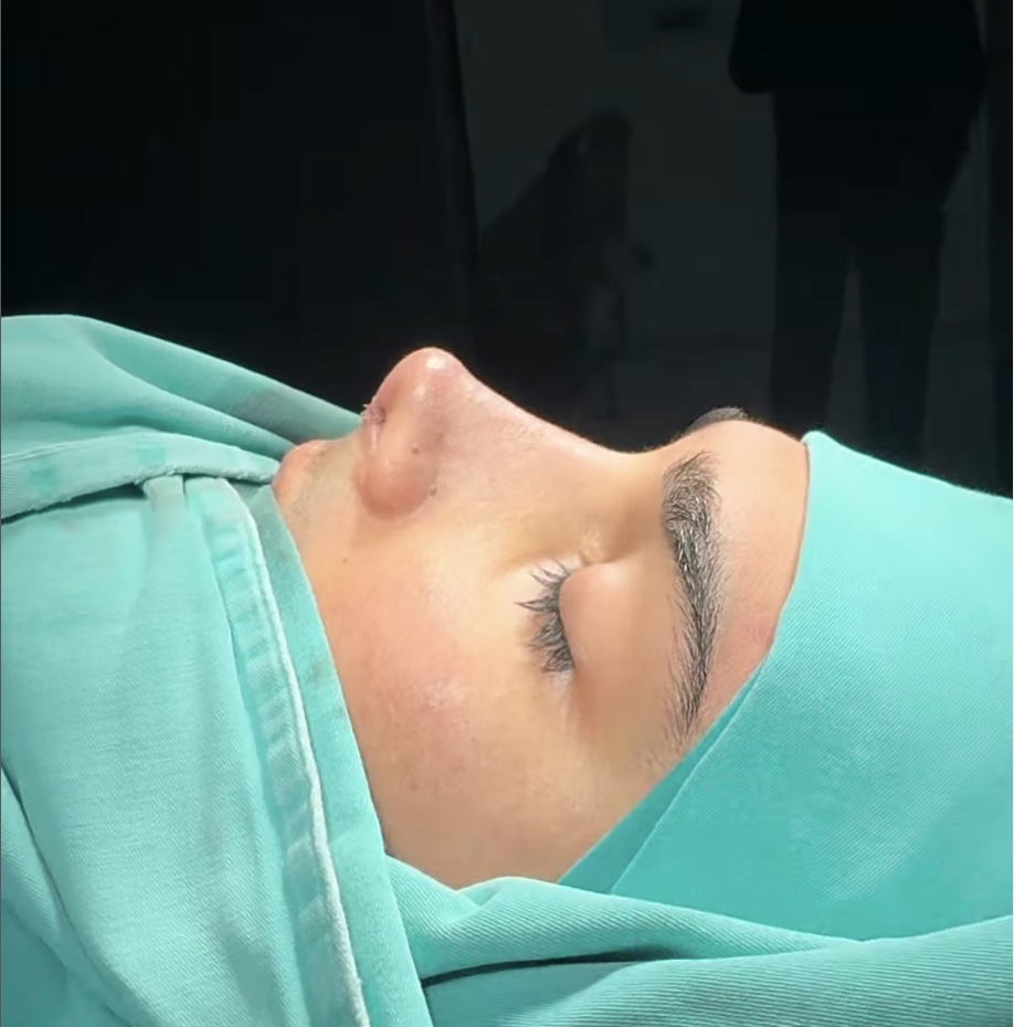 Which country has the best nose job surgeons? Which country has the best nose job surgeons?