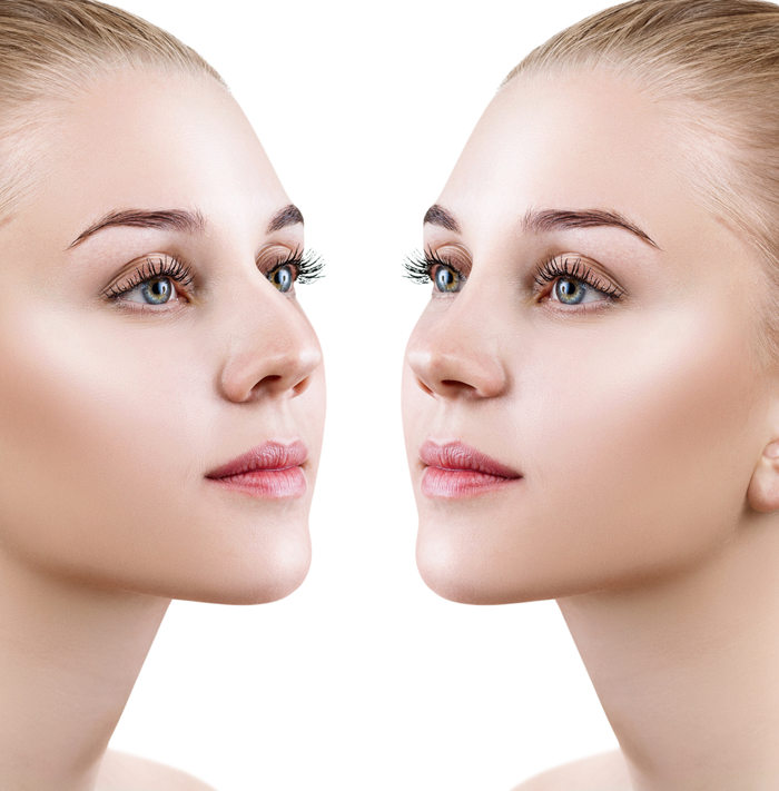 How much to save for a nose job in Turkey?